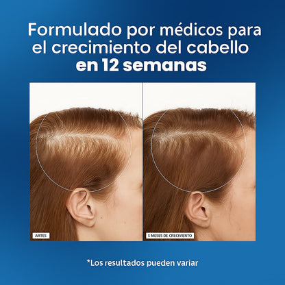 Suero Avanzado de Crecimiento de Cabello en Roll-On